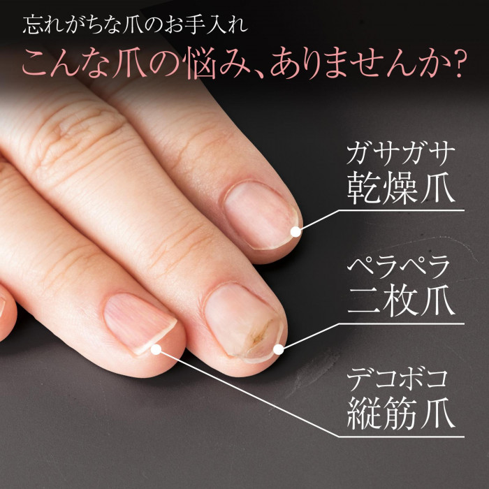 乾燥爪・二枚爪・縦筋爪などの悩み